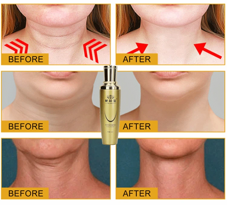 1691144768439829.png 4df937994b642c77a04f44f7de45a73.png