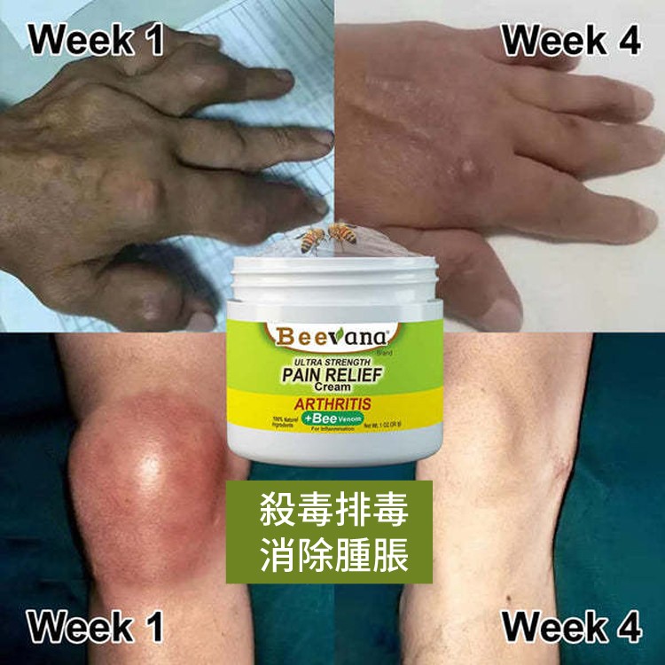 蜂毒關節霜#關節疼痛,#腫脹,全面護理 塗一塗告別疼痛 ☑損傷疼痛☑腫脹變形☑風濕骨痛 蜂毒關節霜#關節疼痛,#腫脹,全面護理 塗一塗告別疼痛 ☑損傷疼痛☑腫脹變形☑風濕骨痛