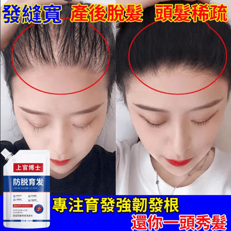 上官博士防脫育發洗發水 火爆熱銷中!台灣本土出貨!24小時在線客服,售後無憂!現在下單享受在線支付立減活動! 上官博士防脫育發洗發水 火爆熱銷中!台灣本土出貨!24小時在線客服,售後無憂!現在下單享受在線支付立減活動!