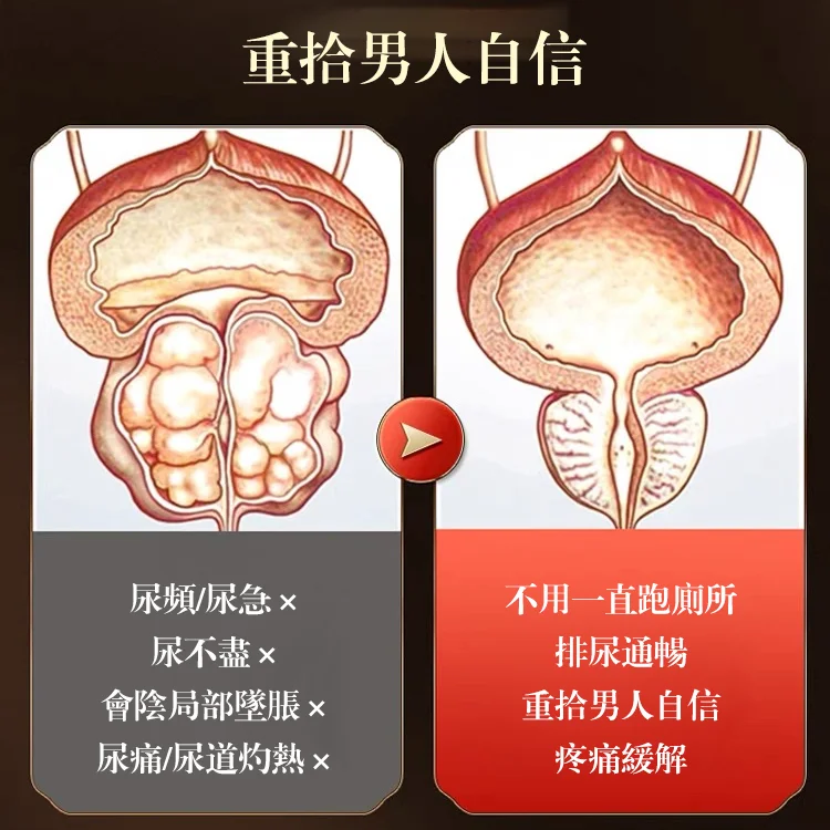 速勃力遠紅外攝護腺理療貼