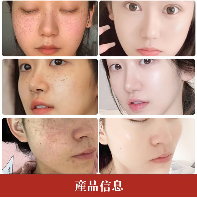 1713701409221284.png 812f54a26566f062ced78425c5af781.png